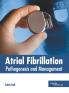 Atrial Fibrillation