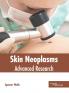 Skin Neoplasms