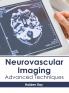 Neurovascular Imaging
