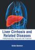 Liver Cirrhosis and Related Diseases