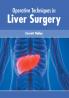 Operative Techniques in Liver Surgery