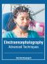 Electroencephalography