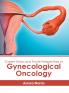 Current Status and Future Perspectives of Gynecological Oncology