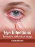 Eye Infections