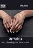 Arthritis