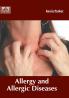 Allergy and Allergic Diseases