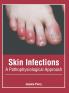 Skin Infections