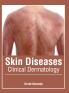 Skin Diseases