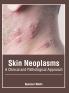 Skin Neoplasms