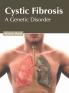 Cystic Fibrosis