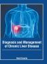 Diagnosis and Management of Chronic Liver Disease