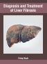 Diagnosis and Treatment of Liver Fibrosis