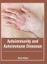 Autoimmunity and Autoimmune Diseases