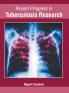 Recent Progress in Tuberculosis Research
