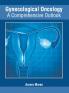 Gynecological Oncology