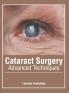 Cataract Surgery