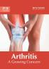 Arthritis
