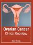 Ovarian Cancer
