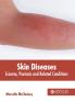 Skin Diseases