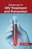 Advances in HIV Treatment and Prevention