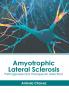 Amyotrophic Lateral Sclerosis