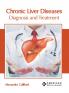 Chronic Liver Diseases