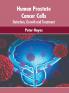 Human Prostate Cancer Cells