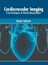 Cardiovascular Imaging