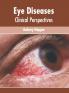 Eye Diseases