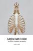 Surgical Back Fusion