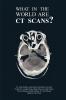 What in the World are CT Scans?