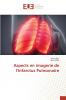 Aspects en imagerie de l'Infarctus Pulmonaire