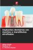 Implantes dentários em maxilas e mandíbulas atrofiadas