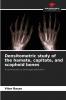 Densitometric study of the hamate capitate and scaphoid bones