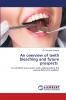 An overview of teeth bleaching and future prospects