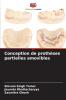 Conception de proth��ses partielles amovibles