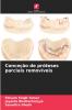 Conceção de próteses parciais removíveis