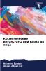 Косметические результаты при ранах на лице