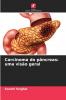 Carcinoma do pâncreas