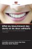 Effet du blanchiment des dents et de deux adhésifs