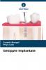 Gekippte Implantate