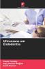 Ultrassons em Endodontia