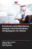 Fractures mandibulaires plaques biorésorbables miniplaques en titane