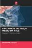 FRACTURAS DO TERÇO MÉDIO DA FACE