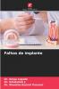 Falhas de implante