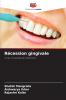 Récession gingivale