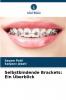 Selbstbindende Brackets