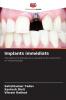 Implants immédiats