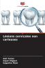 Lésions cervicales non carieuses