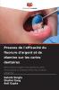 Preuves de l'efficacité du fluorure d'argent et de diamine sur les caries dentaires